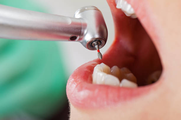 Best Emergency Treatment for Oral Infections in Lawrenceburg, IN